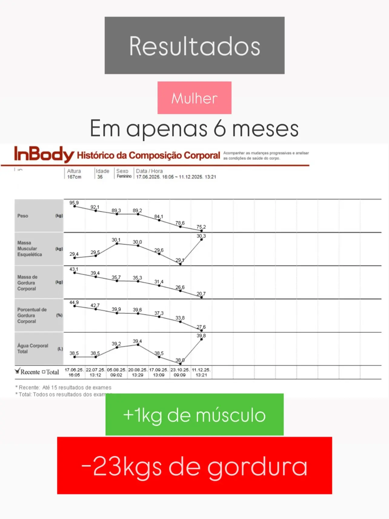 Antes e depois emagrecimento Instituto Vivance Maceió