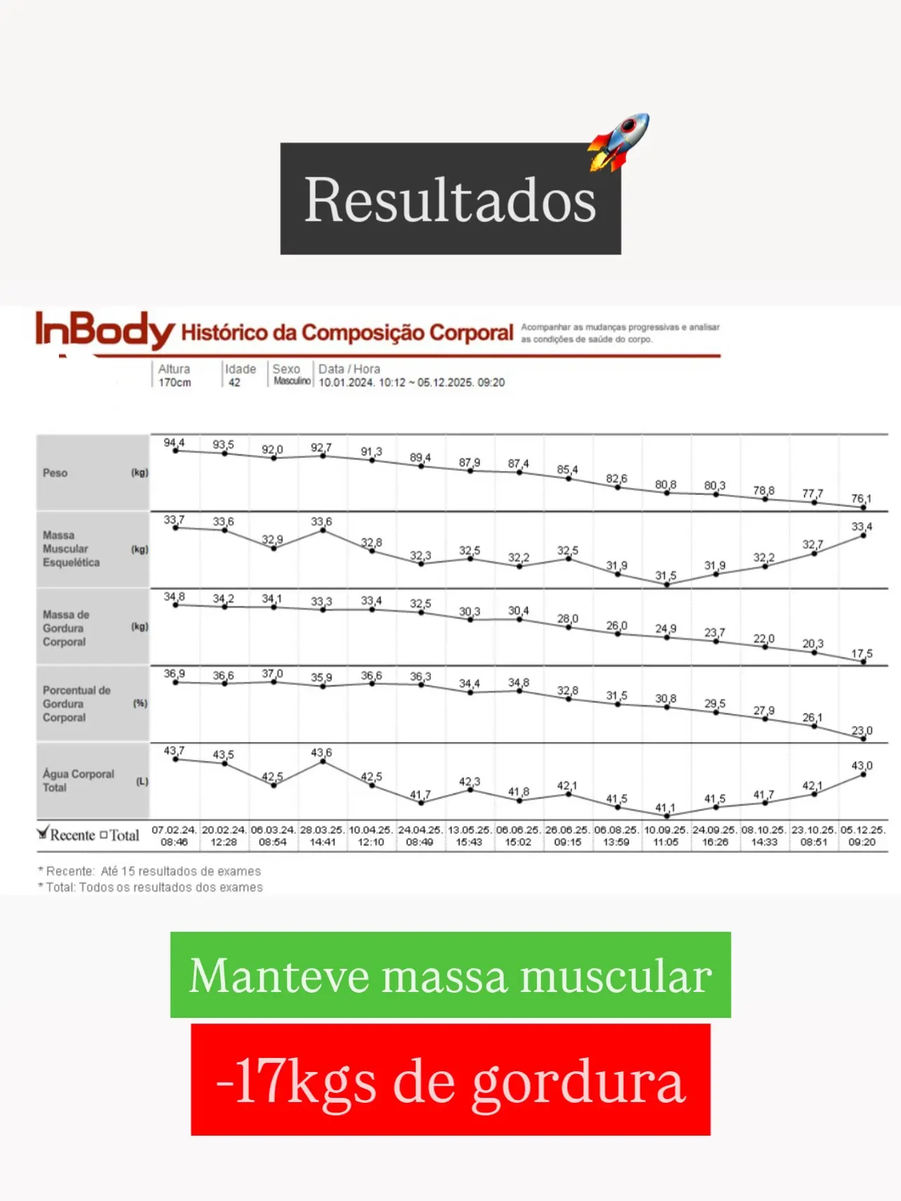 Transformação corporal tratamento obesidade Instituto Vivance